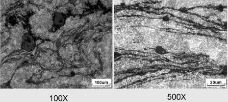 夾雜物型縮孔 夾雜物型縮孔